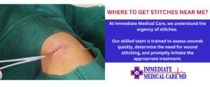 urgent care for stitches